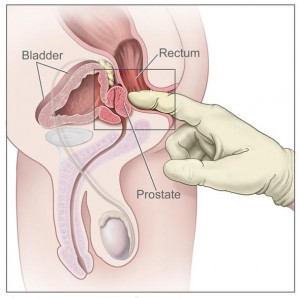 Prostatitis akupunktúra